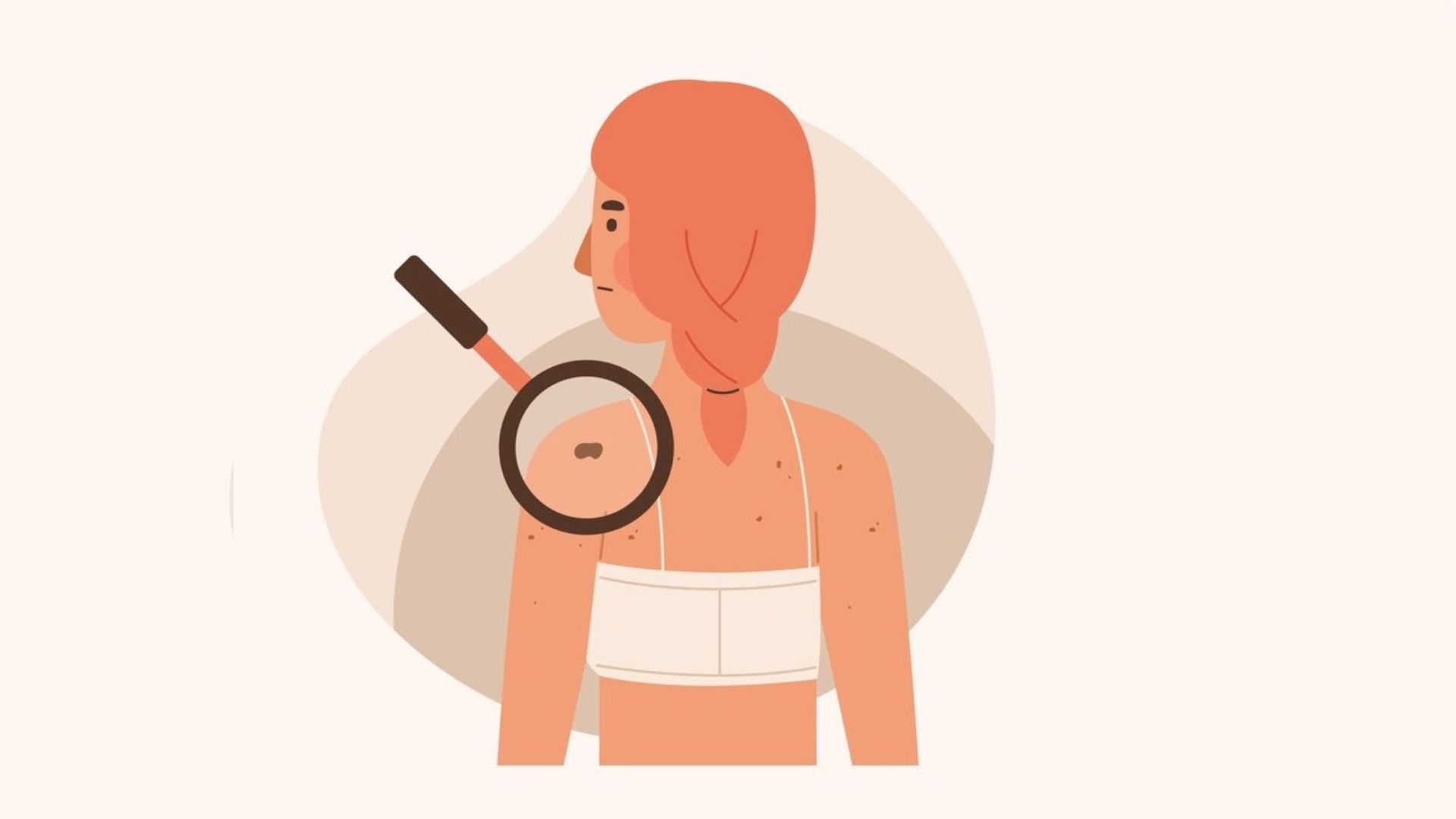 Do dermatologists treat skin cancer?